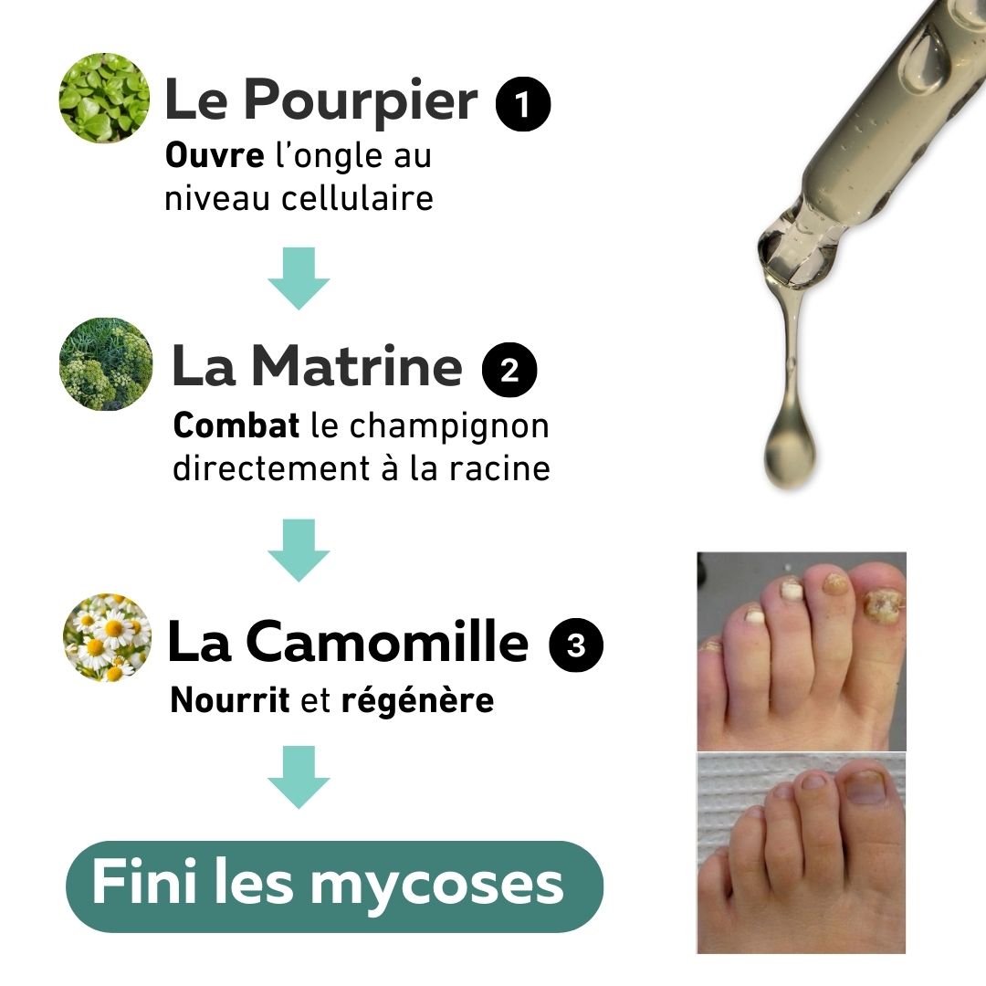 Sérum anti-mycose